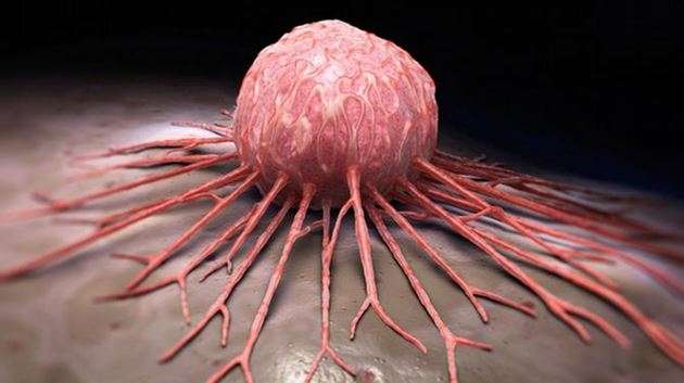 Uzmandan kritik uyarı: Kanserden değil, geç kalmaktan kork