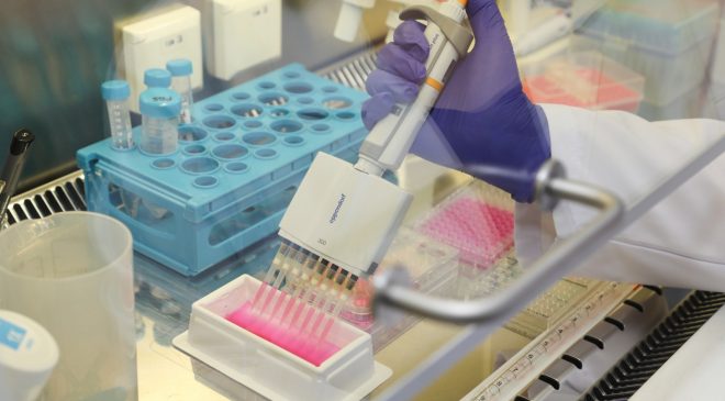 Diyabetik ayak yaralarına karşı Bursa Teknik Üniversitesi’nden jel formüllü çözüm